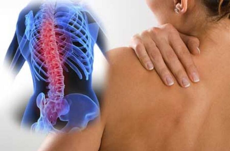 Při osteochondróze může bolest vyzařovat do vzdálených částí těla