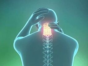 Příznakem cervikální osteochondrózy je bolest hlavy