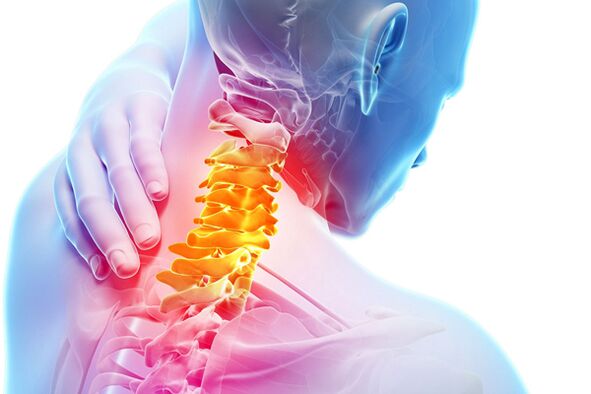 Cervikální osteochondróza