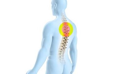 osteochondróza hrudní páteře