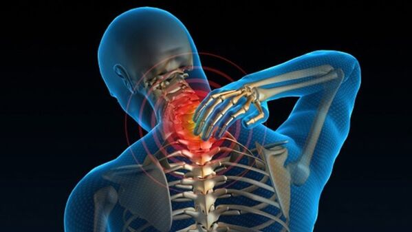 Bolest při otáčení krku může naznačovat syndrom vertebrální cervikální osteochondrózy
