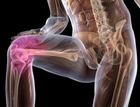 bolest v koleni s artrózou